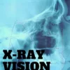 [Ebook] XRay Vision by Vinny Sagoo.